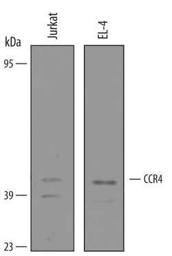 Human/Mouse CCR4 Antibody, R D Systems 25&mu;g; Unlabeled:Antibodies, Polyclonal
