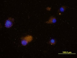 Human CCR5 Antibody, R D Systems 25&mu;g; Unlabeled:Antibodies, Monoclonal