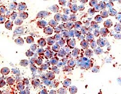 Human CCR6 Antibody, R D Systems 25&mu;g; Unlabeled:Antibodies, Monoclonal