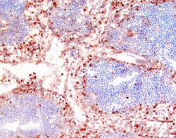 Human CD14 Biotinylated Antibody, R D Systems 50&mu;g; Biotin:Antibodies,