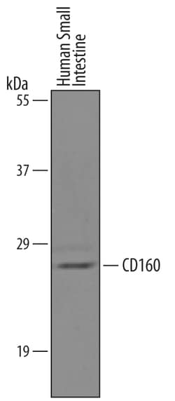 Human CD160 Antibody, R D Systems 100&mu;g; Unlabeled:Antibodies, Polyclonal