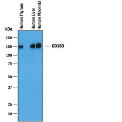 Human CD163 Antibody, R D Systems 100&mu;g; Unlabeled:Antibodies, Polyclonal
