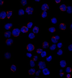 Human CD1a Antibody, R D Systems 25&mu;g; Unlabeled:Antibodies, Monoclonal