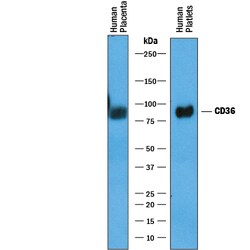 Human CD36/SR-B3 Antibody, R D Systems 25&mu;g; Unlabeled:Antibodies, Polyclonal