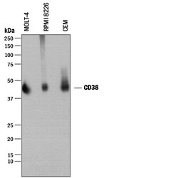 Human CD38 Antibody, R D Systems 100&mu;g; Unlabeled:Antibodies, Polyclonal