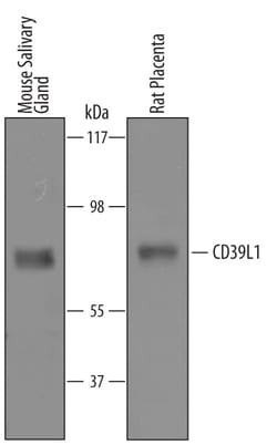 Mouse/Rat CD39L1/ENTPD2 Antibody, R D Systems 25 &mu;g | Buy Online | R&D Systems | Fisher Scientific