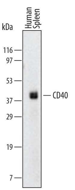 Human CD40/TNFRSF5 Antibody, R D Systems 25 &mu;g | Buy Online | R&D Systems | Fisher Scientific