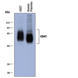 Human CD47 Antibody, R D Systems 100&mu;g; Unlabeled:Antibodies, Polyclonal