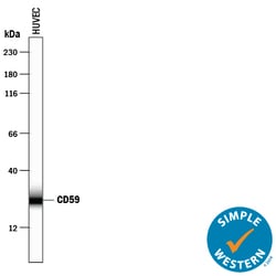 Human CD59 Antibody, R D Systems 25&mu;g; Unlabeled:Antibodies, Polyclonal