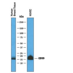 Human CD59 Antibody, R D Systems 25&mu;g; Unlabeled:Antibodies, Polyclonal