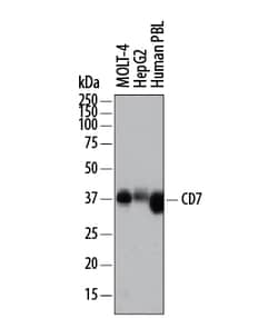 Human CD7 Antibody, R D Systems 25&mu;g; Unlabeled:Antibodies, Polyclonal