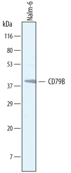 Human CD79B Antibody, R D Systems 25&mu;g; Unlabeled:Antibodies, Polyclonal