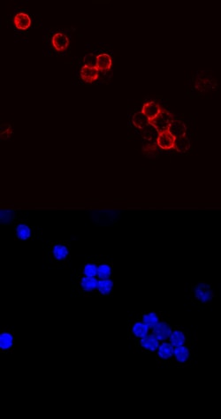 Mouse CD79B Antibody, R D Systems 100&mu;g; Unlabeled:Antibodies, Polyclonal