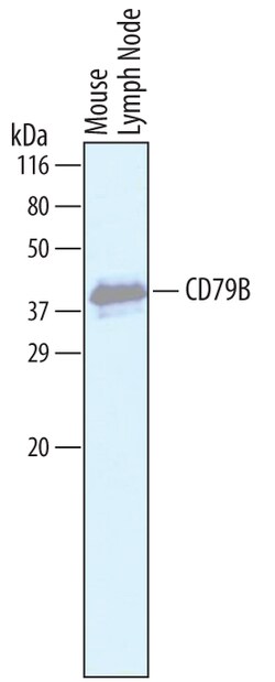 Mouse CD79B Antibody, R D Systems 100&mu;g; Unlabeled:Antibodies, Polyclonal