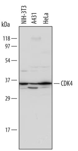 Human/Mouse CDK4 Antibody, R D Systems 100&mu;g; Unlabeled:Antibodies,