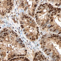 Human CDK8 Antibody, R D Systems 100&mu;g; Unlabeled:Antibodies, Polyclonal