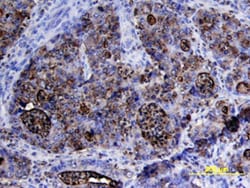 Human CEACAM-5/CD66e Antibody, R D Systems 100ug; Unlabeled:Antibodies,