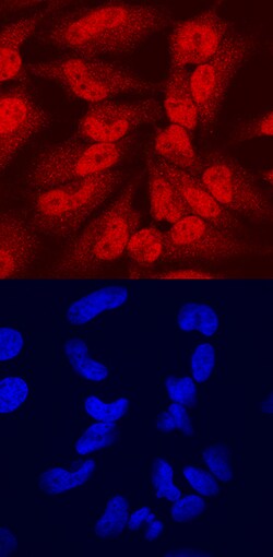 Human CEBP epsilon Antibody, R D Systems 100ug; Unlabeled:Antibodies, Monoclonal