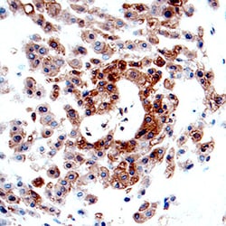 Human CFTR R Domain Antibody, R D Systems 25&mu;g; Unlabeled:Antibodies,