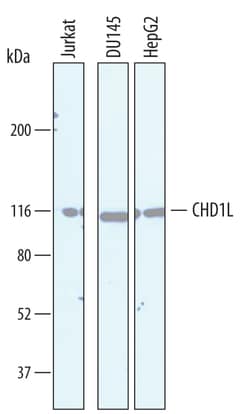 Human CHD1L Antibody, R D Systems 100&mu;g; Unlabeled:Antibodies, Polyclonal