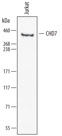 Human CHD7 Antibody, R D Systems 100&mu;g; Unlabeled:Antibodies, Polyclonal