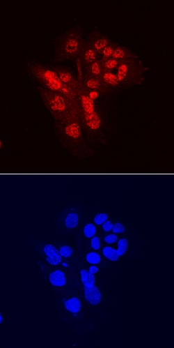 Human CHD7 Antibody, R D Systems 100ug; Unlabeled:Antibodies, Monoclonal