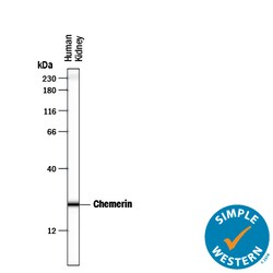 Human Chemerin Antibody, R D Systems 100&mu;g; Unlabeled:Antibodies, Polyclonal