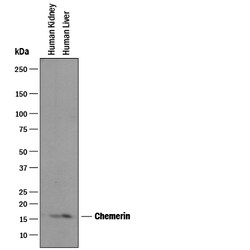 Human Chemerin Antibody, R D Systems 100&mu;g; Unlabeled:Antibodies, Polyclonal