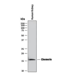 Human Chemerin Antibody, R D Systems 100 &mu;g | Buy Online | R&D Systems | Fisher Scientific