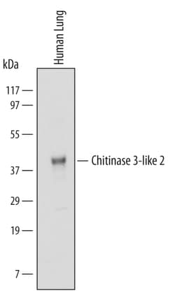 Human Chitinase 3-like 2 Antibody, R D Systems 25&mu;g; Unlabeled:Antibodies,