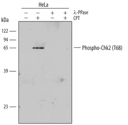 Human Phospho-Chk2 (T68) Antibody, R D Systems 25&mu;g; Unlabeled:Antibodies,