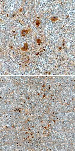 Human CHMP2B Antibody, R D Systems 100ug; Unlabeled:Antibodies, Monoclonal