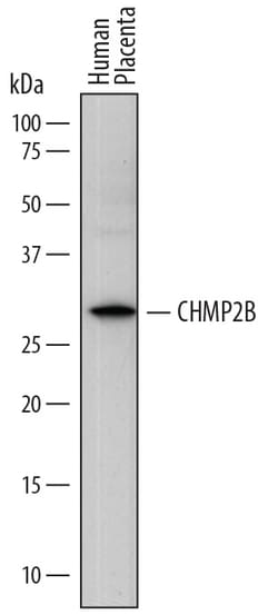 Human CHMP2B Antibody, R D Systems 100ug; Unlabeled:Antibodies, Monoclonal