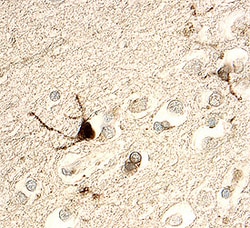 Choline Acetyltransferase/ChAT Goat anti-Human, Polyclonal, R D Systems