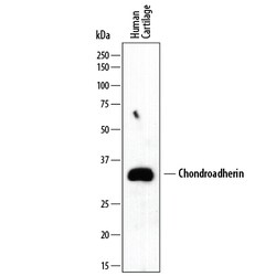 Human Chondroadherin Antibody, R D Systems Unlabeled; 100&mu;g:Antibodies,