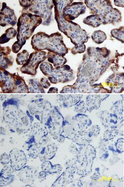 Human Chorionic Gonadotropin alpha Chain ( alpha HCG) Antibody, R D Systems