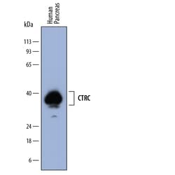Human Chymotrypsin C/CTRC Antibody, R D Systems 25 &mu;g | Buy Online | R&D Systems | Fisher Scientific