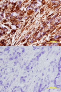Human/Mouse cIAP-2/HIAP-1 Antibody, R D Systems 100ug; Unlabeled:Antibodies,