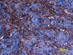 Human/Mouse cIAP-2/HIAP-1 Antibody, R D Systems 100ug; Unlabeled:Antibodies,