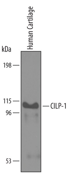 Human CILP-1 N-Terminal Fragment Antibody, R D Systems 100&mu;g; Unlabeled:Anticorps,
