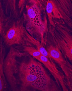 Human Clathrin Heavy Chain 2/CHC22 Antibody, R D Systems 25 &mu;g | Buy Online | R&D Systems | Fisher Scientific