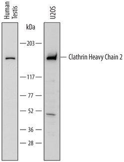 Human Clathrin Heavy Chain 2/CHC22 Antibody, R D Systems 25 &mu;g | Buy Online | R&D Systems | Fisher Scientific