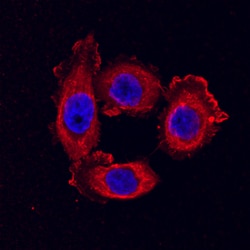 Human Claudin-3 Antibody, R D Systems 100ug; Unlabeled:Antibodies, Monoclonal