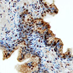 Human CLC Antibody, R D Systems 500ug; Unlabeled:Antibodies, Monoclonal