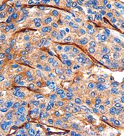 Human CLEC14A Antibody, R D Systems 100&mu;g; Unlabeled:Antibodies, Polyclonal