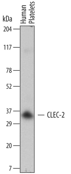 Human CLEC-2/CLEC1B Antibody, R D Systems 25 &mu;g | Buy Online | R&D Systems | Fisher Scientific