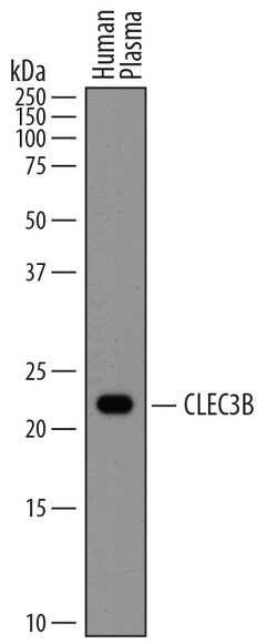 Human CLEC3B/Tetranectin Antibody, R D Systems 25&mu;g; Unlabeled:Antibodies,