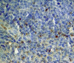 Human CLEC9a Antibody, R D Systems 100&mu;g; Unlabeled:Antibodies, Polyclonal