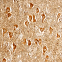Human Clusterin aa 22-227 Antibody, R D Systems 25&mu;g; Unlabeled:Antibodies,