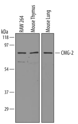Mouse CMG-2/ANTXR2 Antibody, R D Systems 100&mu;g; Unlabeled:Antibodies,